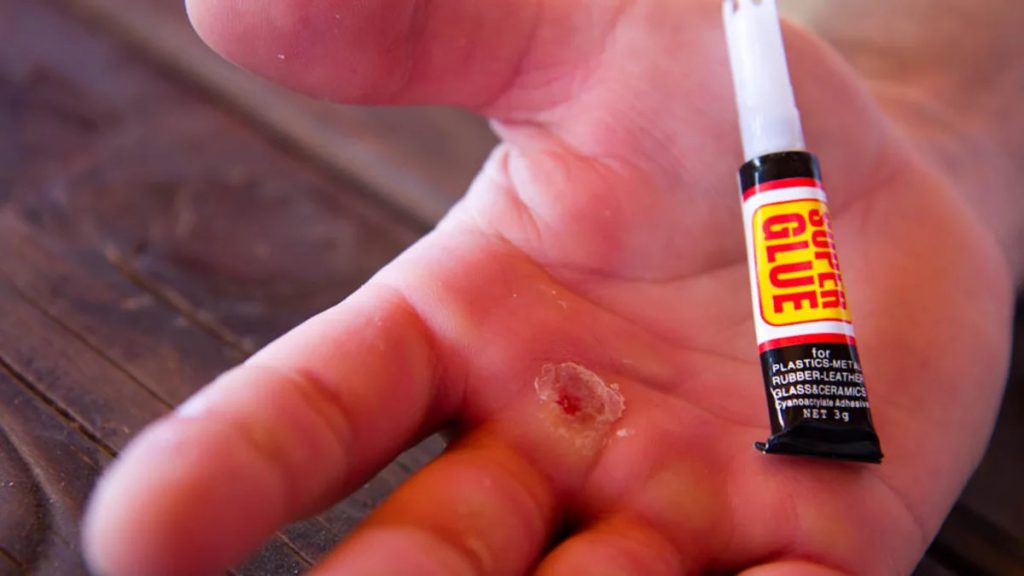 Como quitar el Super Glue de la piel y otras Superficies